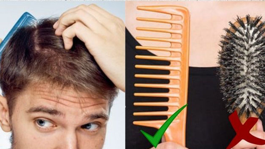A GUIDE TO NON-SURGICAL HAIR REPLACEMENT SYSTEM (20)