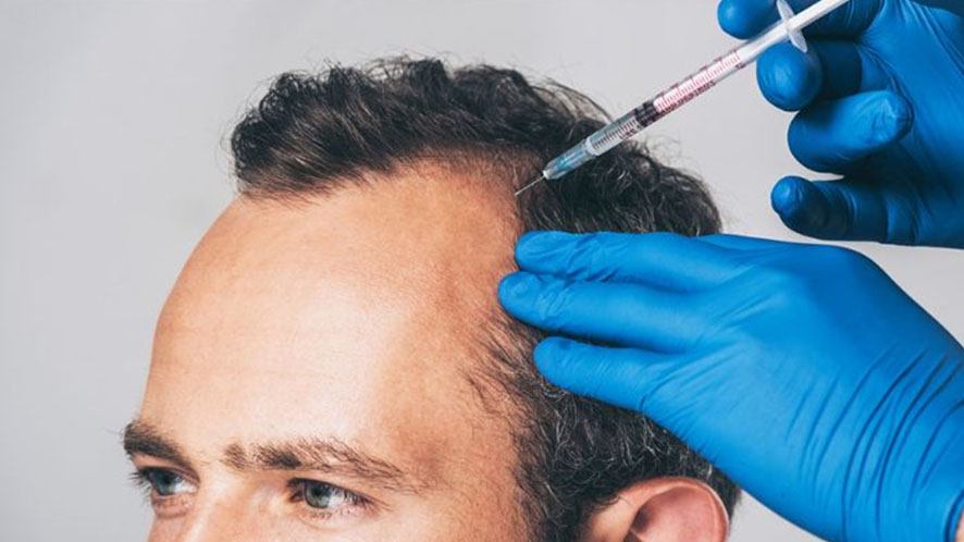 A COMPLETE GUIDELINE TO NON-SURGICAL HAIR RESTORATION (2)