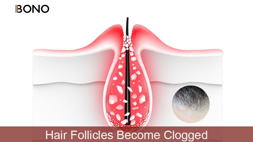 Men’s Hair Regrowth Secrets You Never Knew (13)