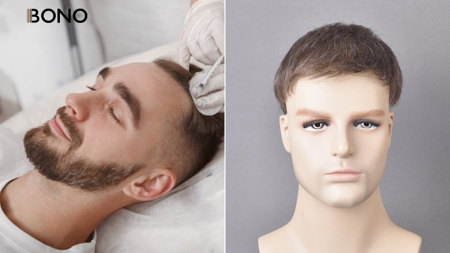 Men’s Hair Regrowth Secrets You Never Knew (8)