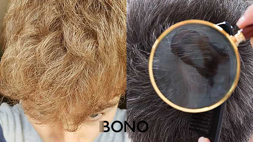 Skin Hair System Guide - Why Skin Hair System Is Popular (11)