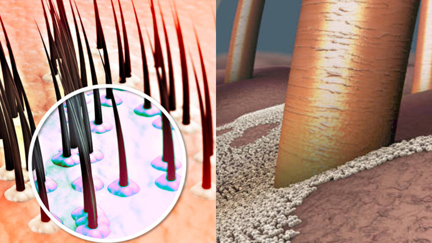 How To Stop Hair Loss (20)