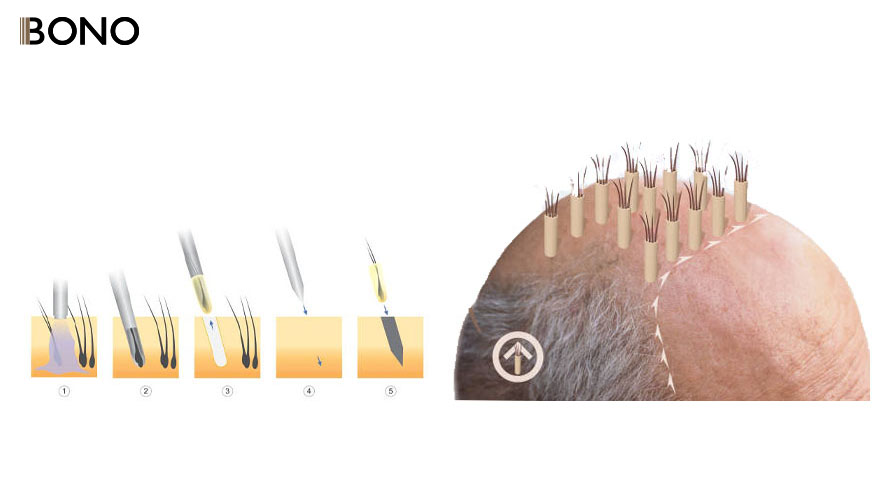 How To Stop Hair Loss (8)