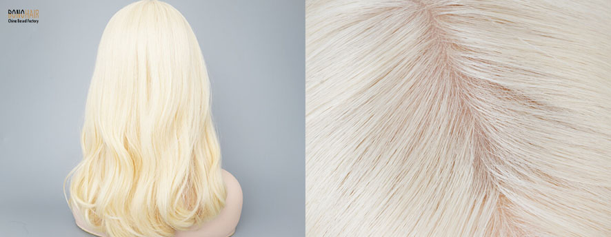 What is Alopecia and Alopecia Treatment (8)