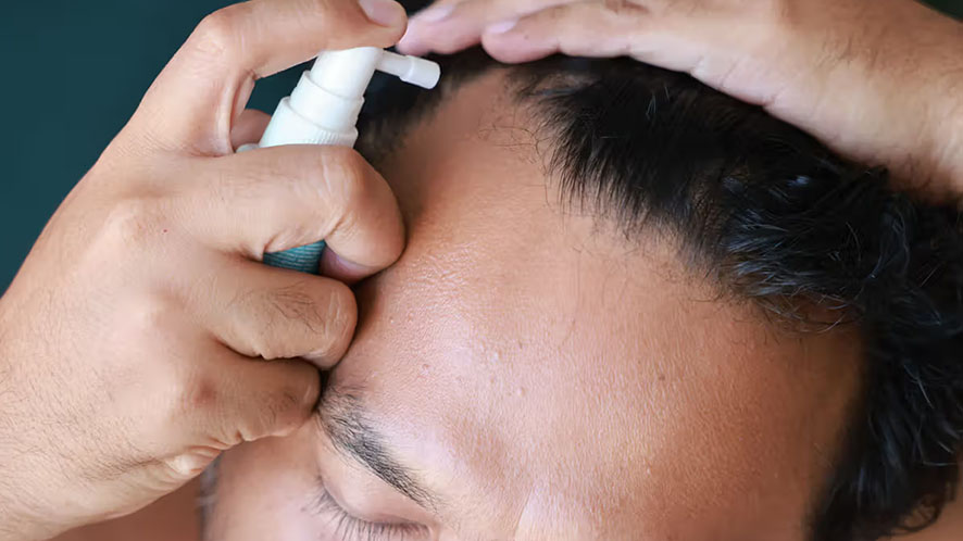 A Complete Guideline To Non-surgical Hair Restoration (7)